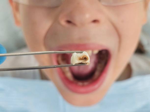 Best Emergency Gum Treatment in Waite Park, MN